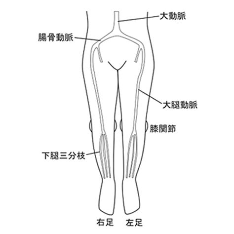 末梢動脈疾患検査・治療 神奈川県横浜市の昭和大学藤が丘病院 循環器内科