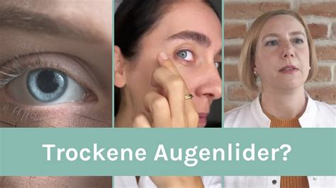 Trockene Augenlider Wie Lassen Sich Trockene Augenlider Gut Pflegen