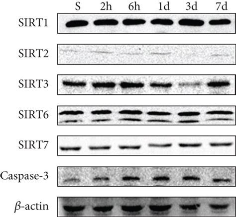 Effects Of HIR On Sirtuin Expression A Representative Blots Of