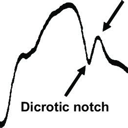 Suture and descent of the prosthetic aortic ring | Download Scientific Diagram