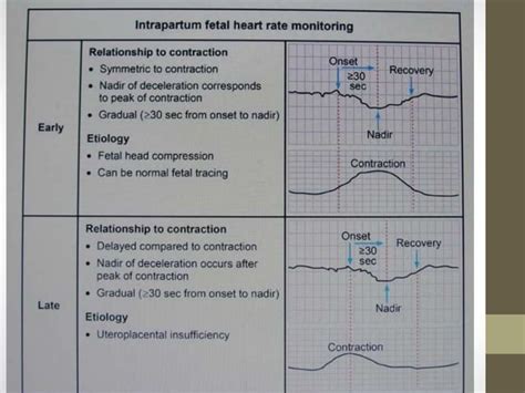 Evaluating Of Fetal Heart Tracing Ppt Free Download