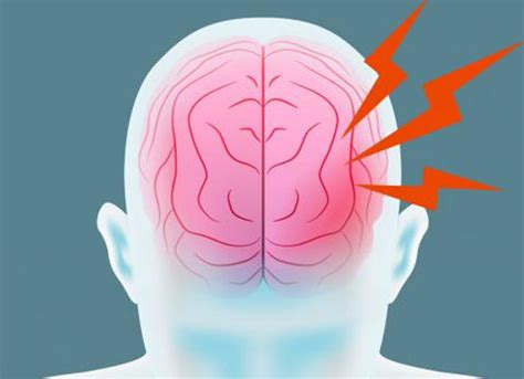 ¿ Cómo Prevenir Un Accidente Cerebrovascular