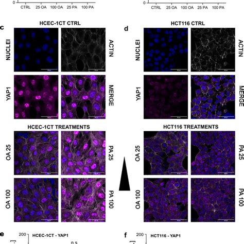 Effect Of Oa And Pa On Piezo Treatments With Pa And Oa And Resulting