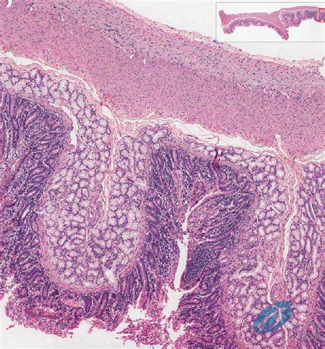 Lab 9 The Layers Of The Duodenum Diagram Quizlet