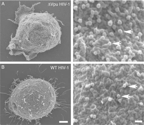 Hiv Virus Scanning Electron Microscope