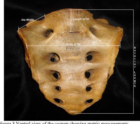 Figure 1 From Sexual Dimorphism Of The Posterior Pelvis Of The Robert J