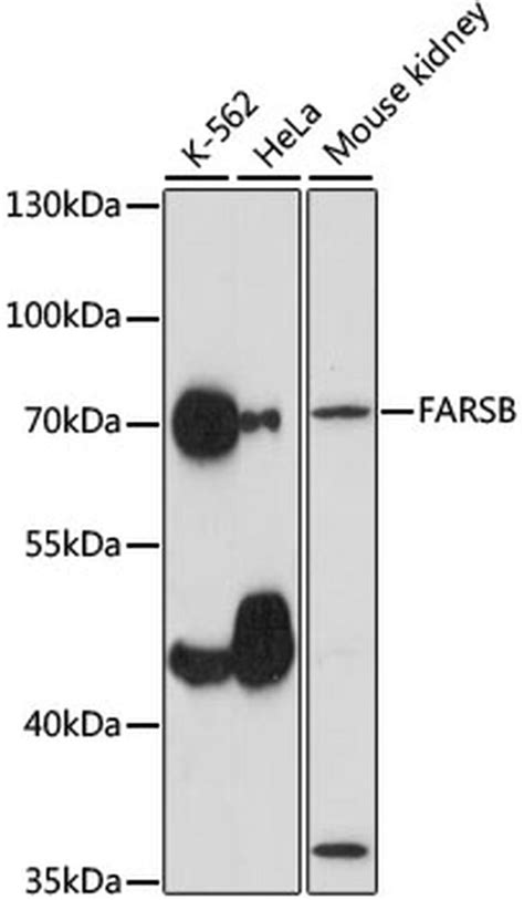 Farsb Polyclonal Antibody Pa5 120354