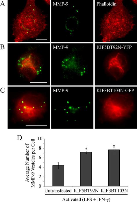 Trafficking Of Mmp Vesicles Is Mediated By The Mt Motors Kinesin B