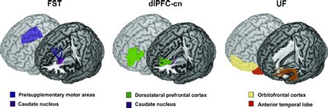 Three Cortico Striatal Tracts Of Interest Virtual In Vivo Dissections