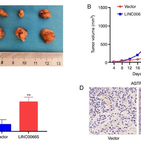 LINC00665 In U87 MG Cells Promotes Tumor Growth In Vivo A Typical