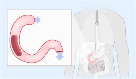 Duodenum: What Is, Anatomy, Functions, Diseases, and Medical Examinations