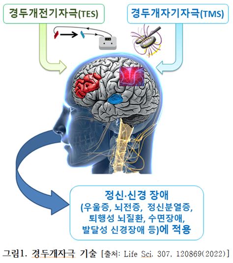 디지털치료제와 전자약에 의한 의약 산업의 패러다임 전환 ㉘