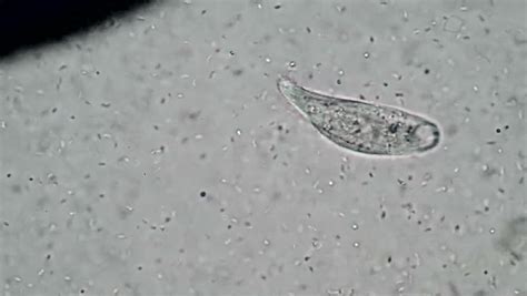 Spathidium Feeding On Motile Spirilla Bacteria. A Good View Of The Mouth Structure Of This ...