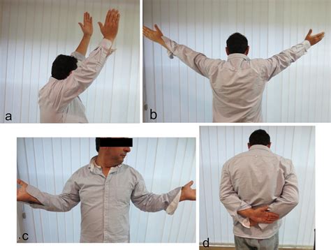 A Patient Mobility 12 Months After Surgery 150° Shoulder Flexion B Download Scientific