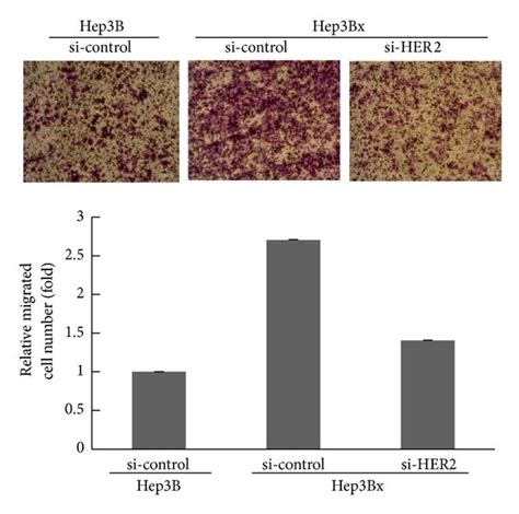 The Increased Her2 Protein Expression Was Responsible For The Migration