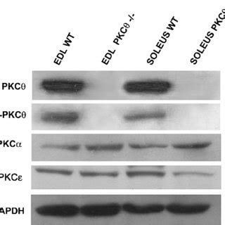 Expression Of NPKC Specific Isoforms In Soleus Sol And Extensor