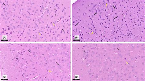 A Section Of The Cerebral Cortex Stained With H E Viewed At The