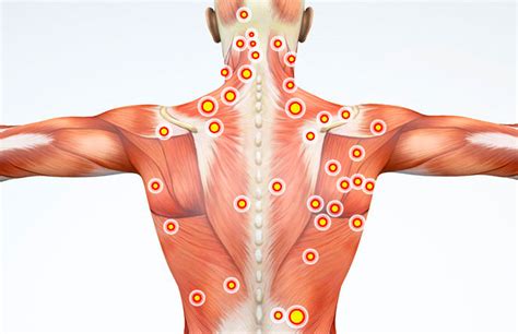 Triggerpunkttherapie Mit Diesen Tipps Können Sie Sich Selbst Behandeln