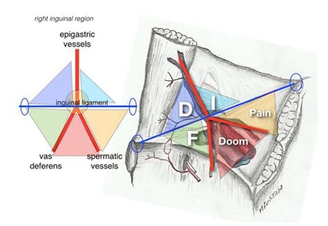 Producción colateral Producción anatomia inguinal laparoscopica