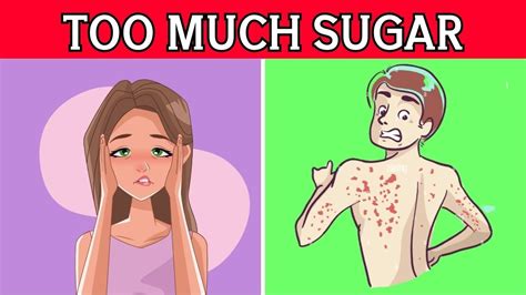 Warning Signs That You Are Eating Too Much Sugar Youtube