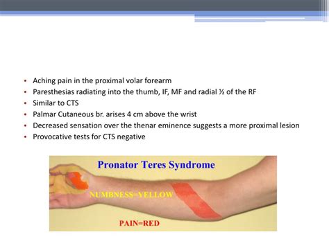 PPT - Nerve Compression Syndromes PowerPoint Presentation, free ...