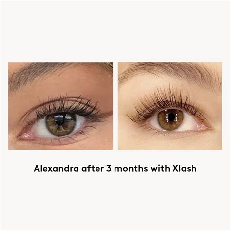 Xlash Pro Eyelash Serum 6ml Naturally Long Eyelashes Xlash