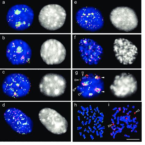 Telomere And Trf Mtbp Localization At Different Cell Cycle Stages