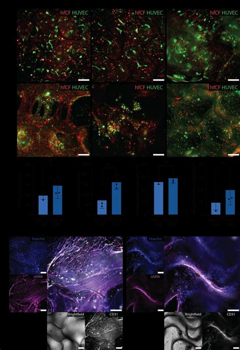 In Vitro Hydrogel Selection For The Vascular Bioink Vascb A