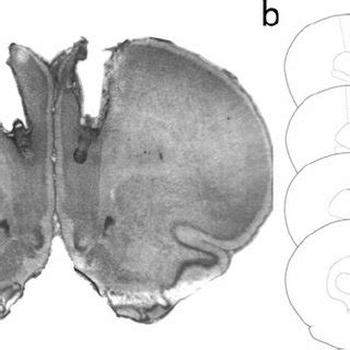 Histological Analysis Of Intra VTA Cannulae Placements A