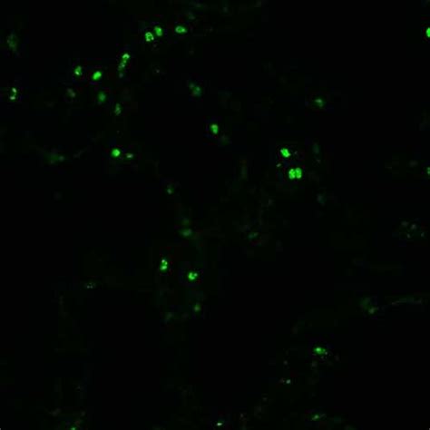 Human Mash1ascl1 Cdna Clones Hg14170 Sino Biological