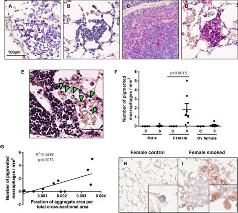 Sex Differences In Lymphoid Follicles In Copd Airways Respiratory Research