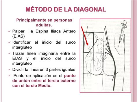 INYECTOTERAPIA VIAS DE ADMINISTRACIÓN ppt