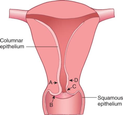 Female Reproductive System Stis Flashcards Quizlet