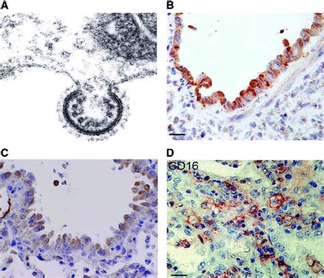 RSV Replication And Pathology A Electron Micrograph Of RSV Budding