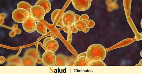 Candida Auris Qu Es S Ntomas Y Tratamiento