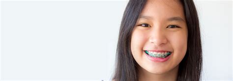 Clinique M Dicale Orthosmile Traitements D Orthodonties