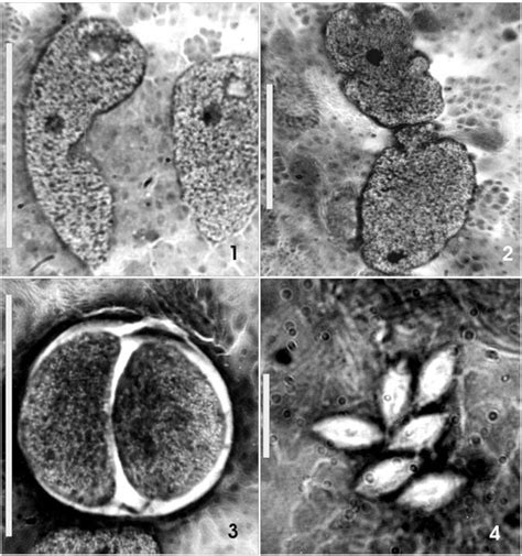 Photomicrographs of different stages of the life cycle of Monocystis... | Download Scientific ...