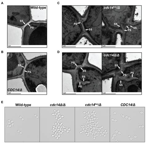 Frontiers Cdc14 Phosphatase Contributes To Cell Wall Integrity And