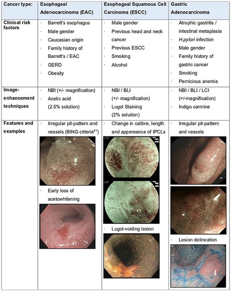 Quality Indicators In Diagnostic Upper Gastrointestinal Endoscopy