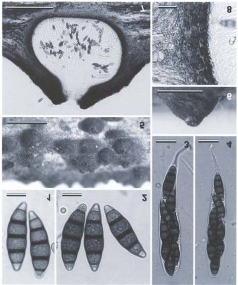 Micrographs Of Trematosphaeria Crassiseptata Ascospores