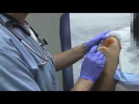 How To Give A Subacromial Injection