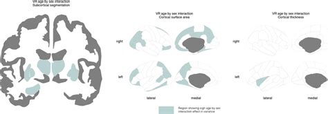 Regions Where Sex Differences In Variability Of Brain Structure