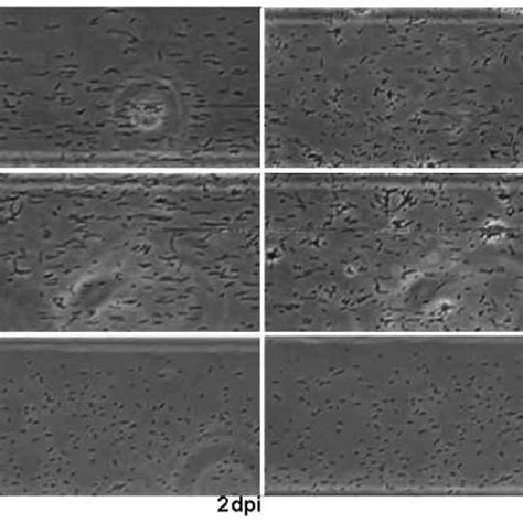 Evaluation Of Cell To Cell Aggregation Of X Fastidiosa At Different Cu