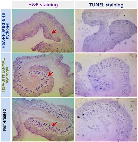 Albuminbased Hydrogels For Regenerative Engineering And Cell