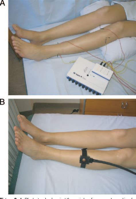 Figure 1 From Bilateral Acupuncture Analgesia Observed By Quantitative