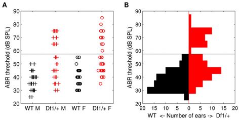 Elevated ABR Thresholds And Bimodal Distribution Of Thresholds In