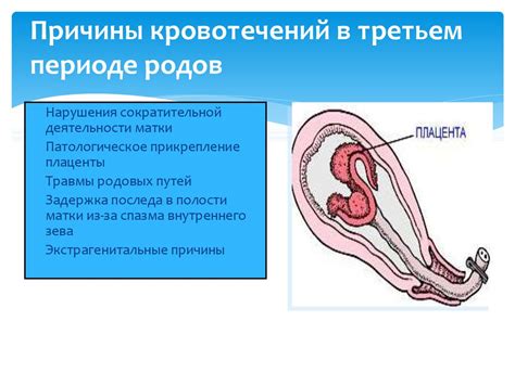 Кровотечения в родах и послеродовом периоде - презентация онлайн