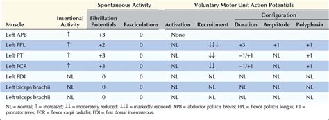 Proximal Median Neuropathy | Neupsy Key