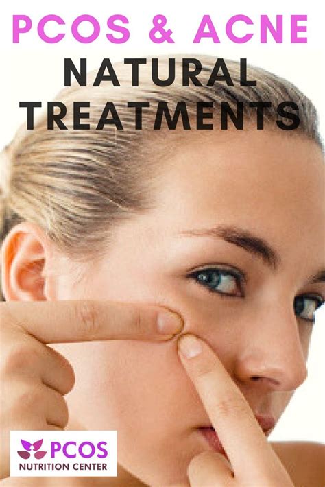 Pcos And Acne Natural Treatment Options Pcos Nutrition Center