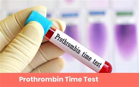 Prothrombin Time Pt And Inr International Normalized Ratio